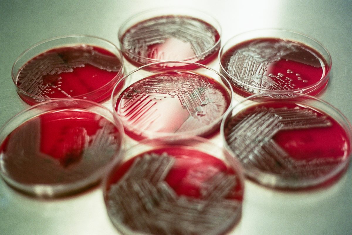 AST Method Verification Isolates for New Agents – Laboratory ...
